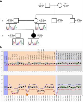 Case report: atypical Silver-Russell syndrome patient with hand dystonia: the valuable support of the consensus statement to the wide syndromic spectrum